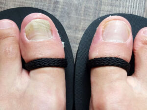 XERO SHOES JESSIEの親指部分