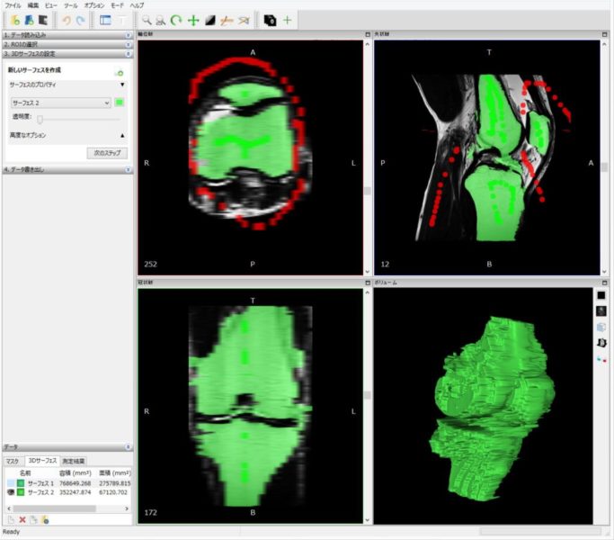 InVesaliusのサーフェス生成結果